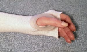 thumb-ring-application-step1